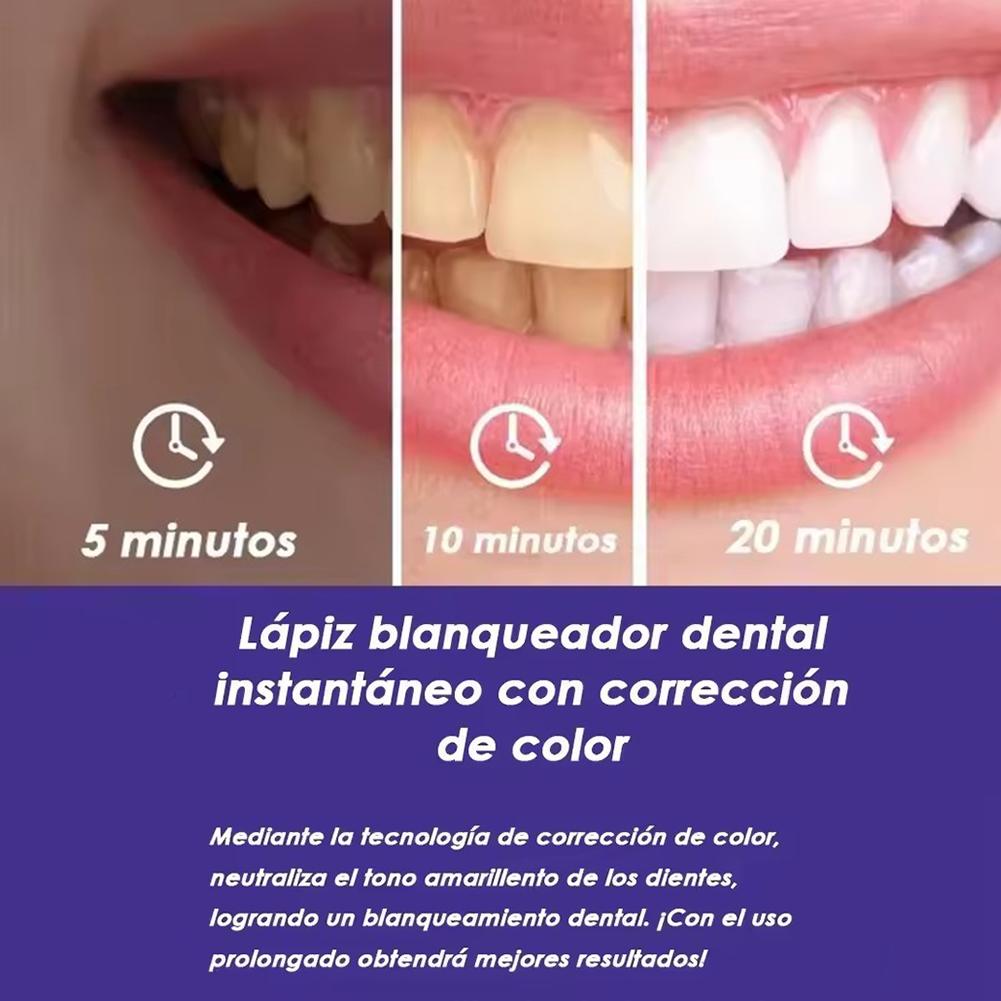 UBESTSMILE V34&PAP+ Formula Pu - đánh giá và giá Teeth Whitening Pens