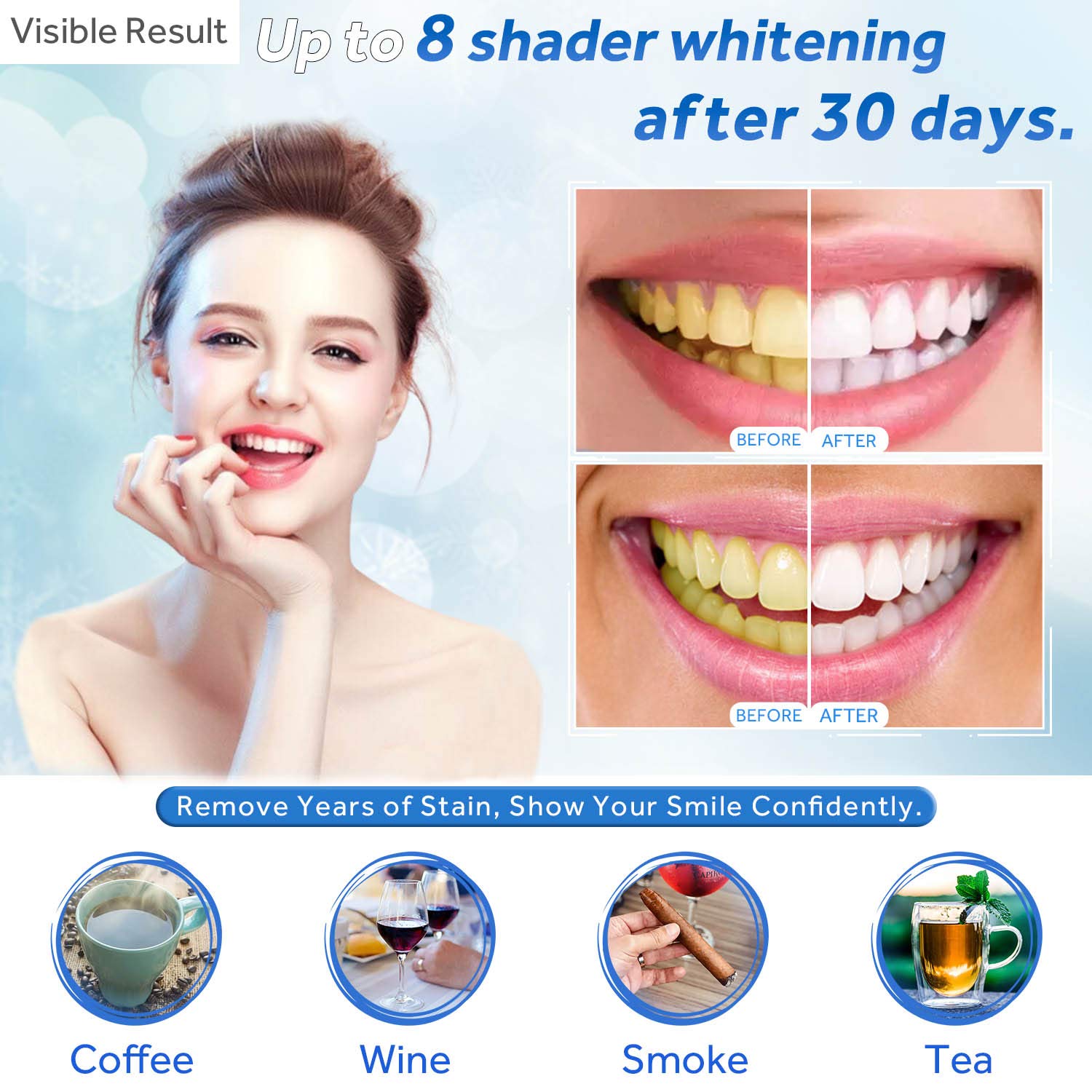 Teeth Whitening Gel Refill Syr - đánh giá và giá Teeth Whitening Flash