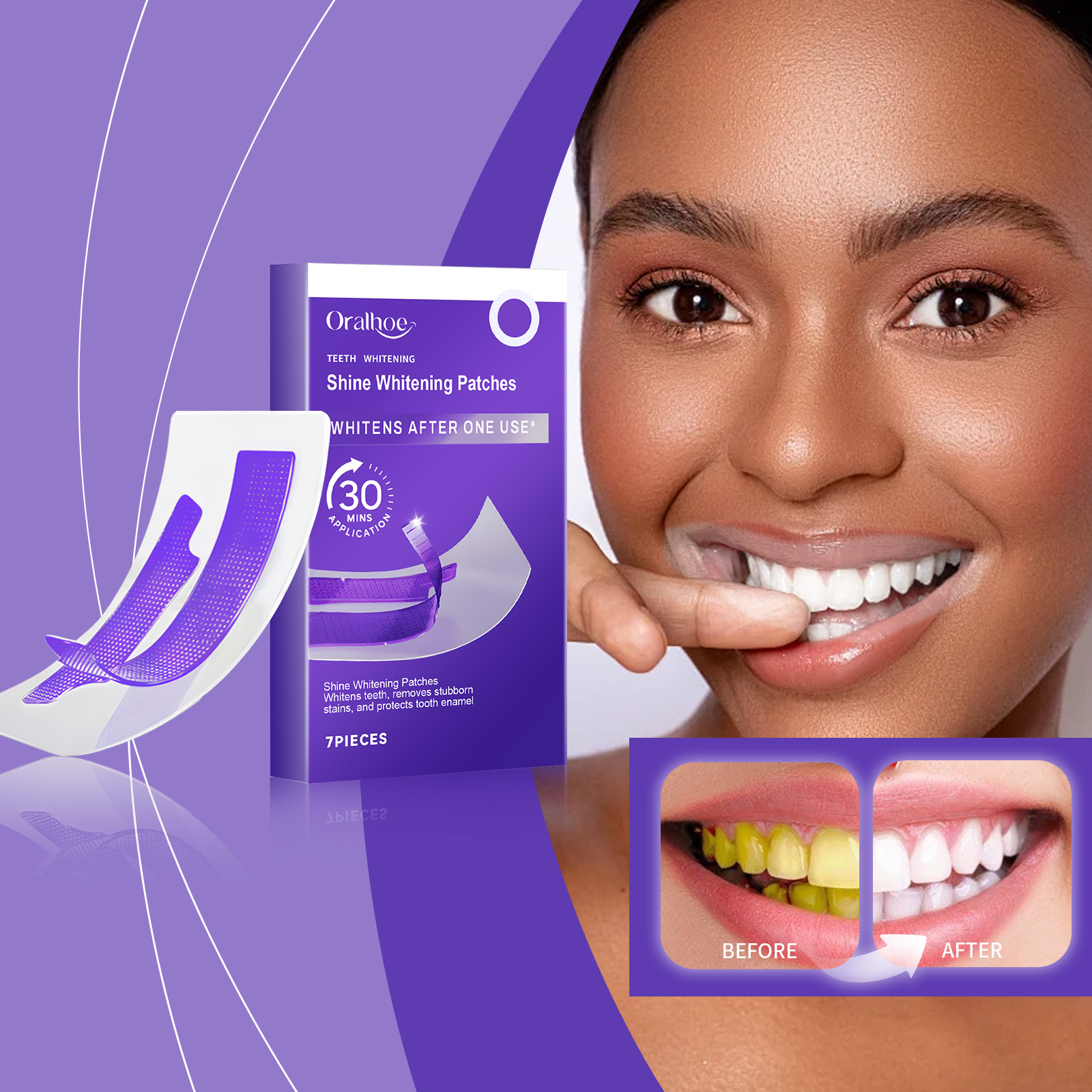 Purple Teeth Whitening Strips  - đánh giá và giá Teeth Whitening Flash