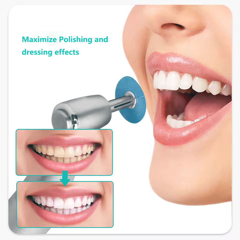 40pcs Dental Polishing Discs H - đánh giá và giá Teeth Whitening Express
